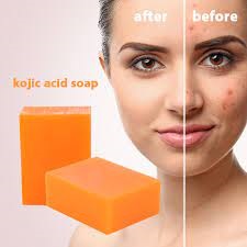 Kojic acid soap side effects