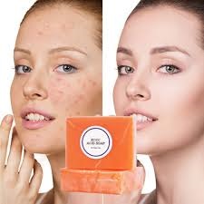 Kojic acid soap side effects