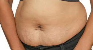 Tips to reduce belly fat after delivery